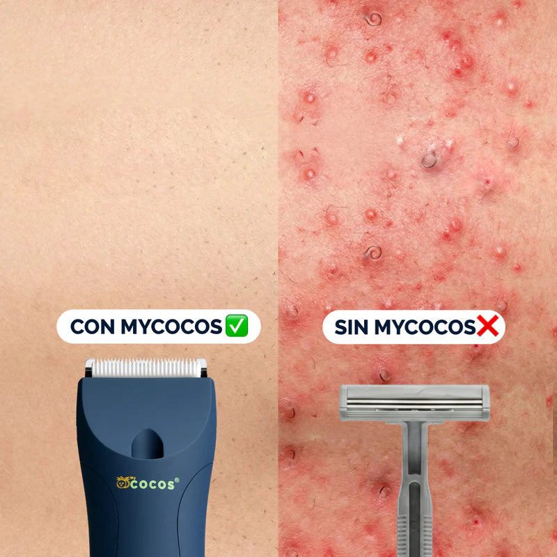La rasuradora que cuida tu piel.