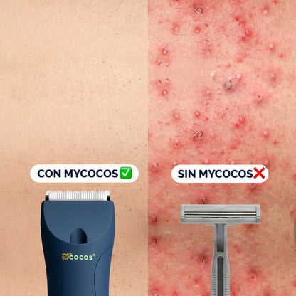 La rasuradora que cuida tu piel.